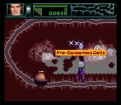 Rex Ronan: Experimental Surgeon
